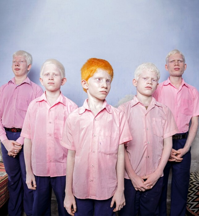 Blue background, five boys with albinism wearing pink blouses, the one in front has bright orange hair, the other boys have white hair.