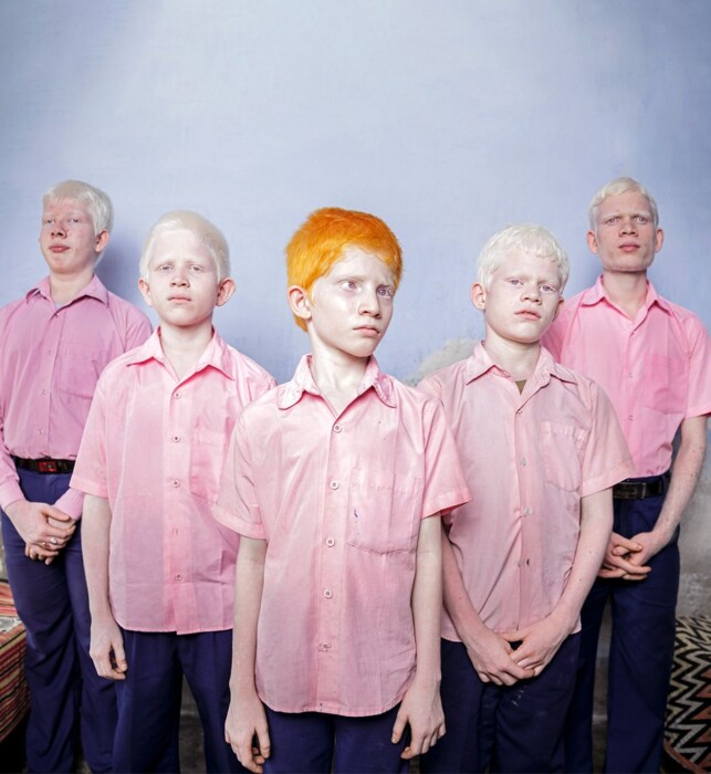 Blue background, five boys with albinism wearing pink blouses, the one in front has bright orange hair, the other boys have white hair.